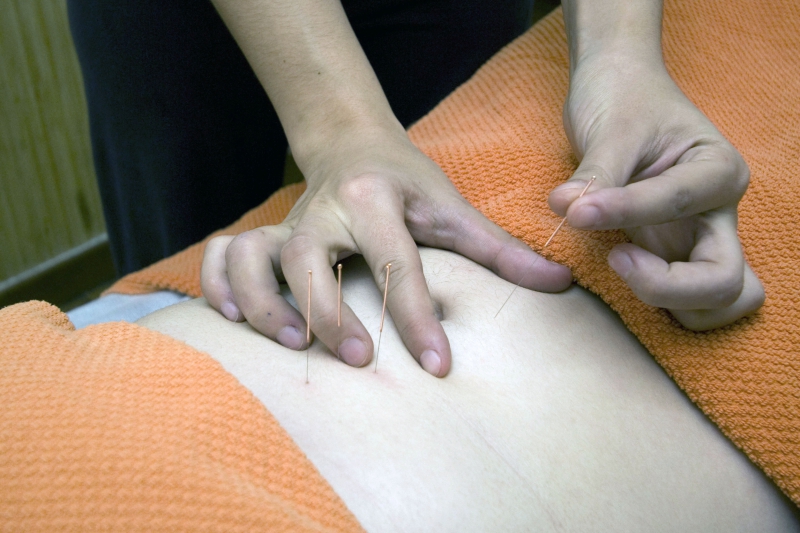 osteopathe-COLOMARS-min_acupuncture-4175625